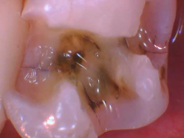 ProDENT Intraoral Camera PD740, Capture Button Driver to Work with Eaglesoft, Dexis, Apeteryx, Carestream, Tigerview customer photo 1