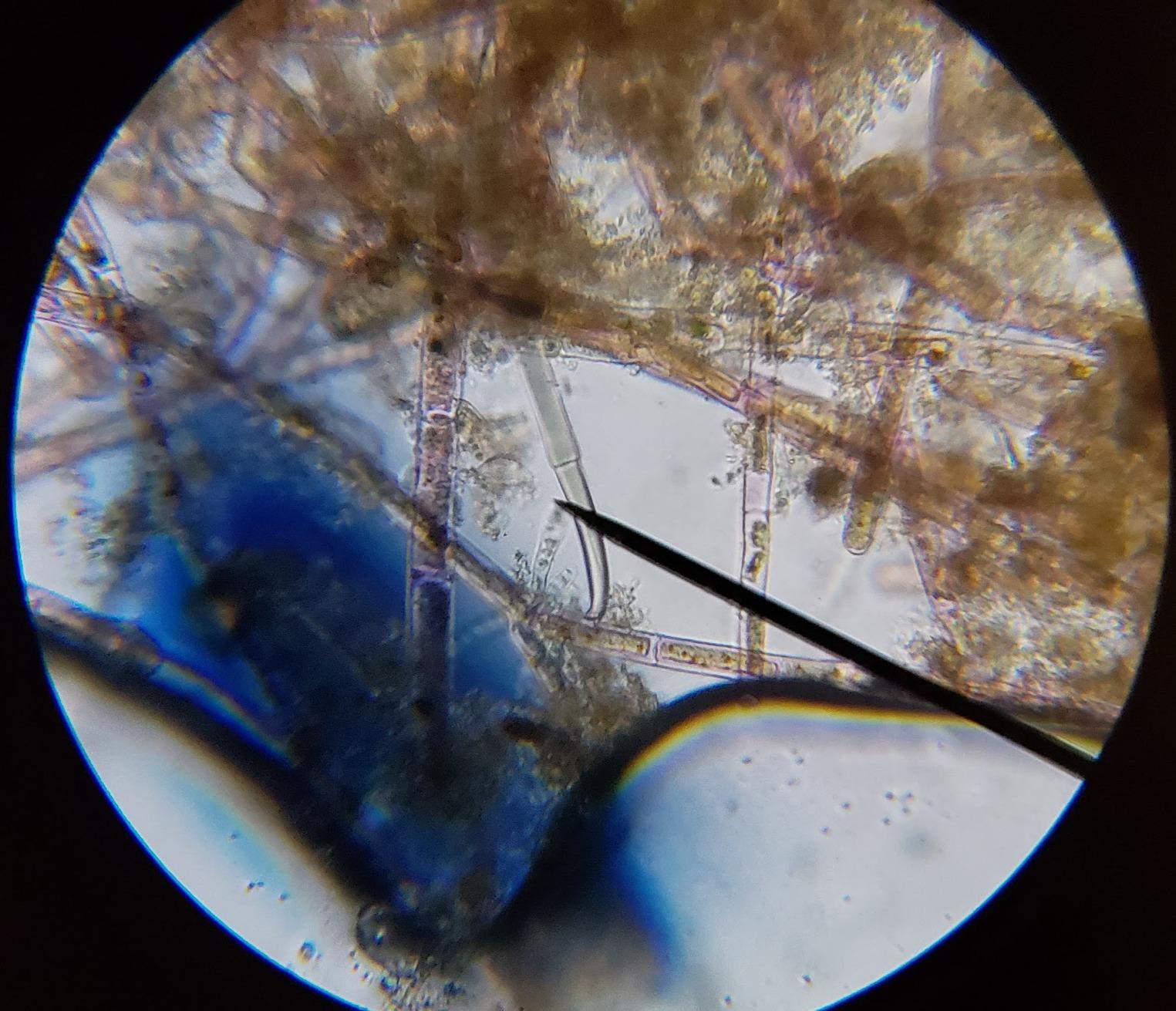 AmScope M150C 1000X All-Metal Optical Glass Lenses Cordless LED | 40X-1000X Magnification Range Compound Biological Microscope All-Metal Construction Cordless Battery Powered customer photo 2