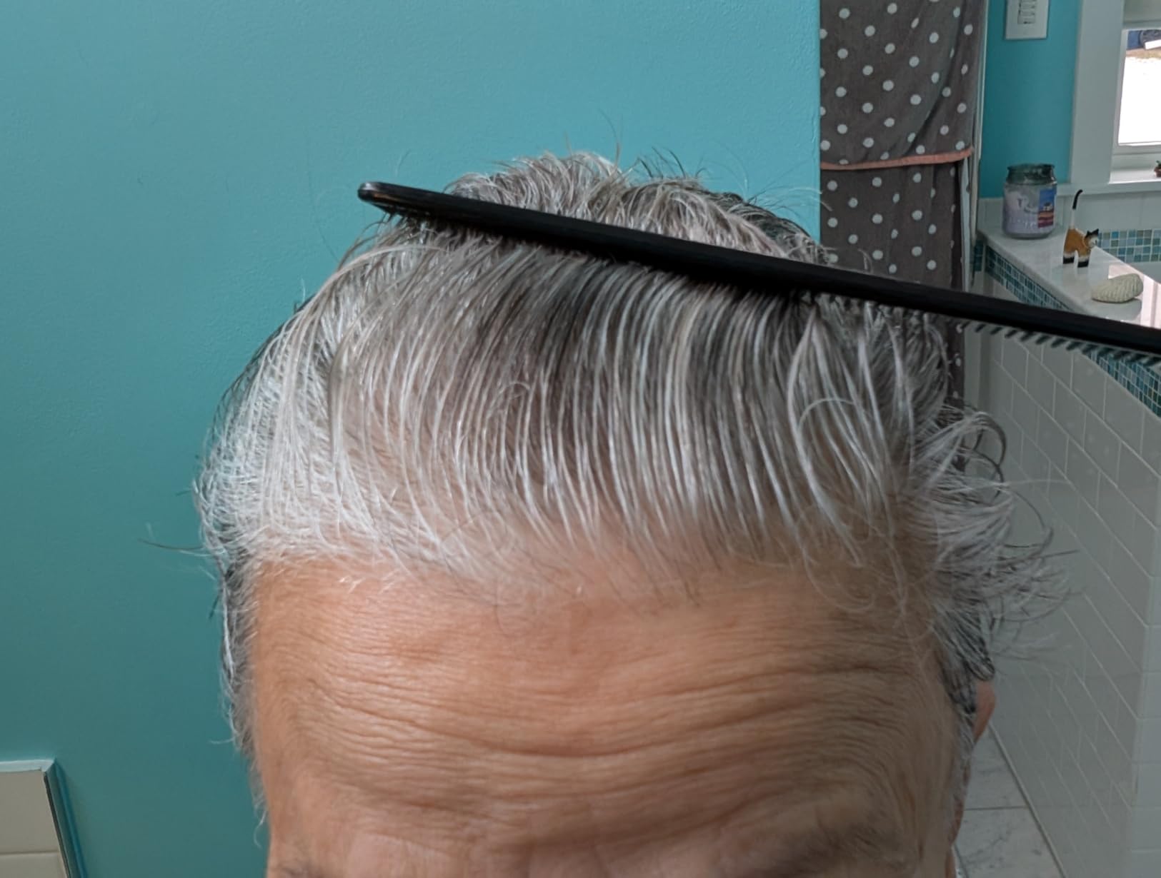 illumiflow 272 Laser Cap for Hair Growth - FDA Cleared Low Level Laser Therapy Hair Regrowth System for Men & Women - Hair & Scalp LLLT Hat w/Lasers Stops Hair Loss & Regrows Thinning Hair customer photo 1