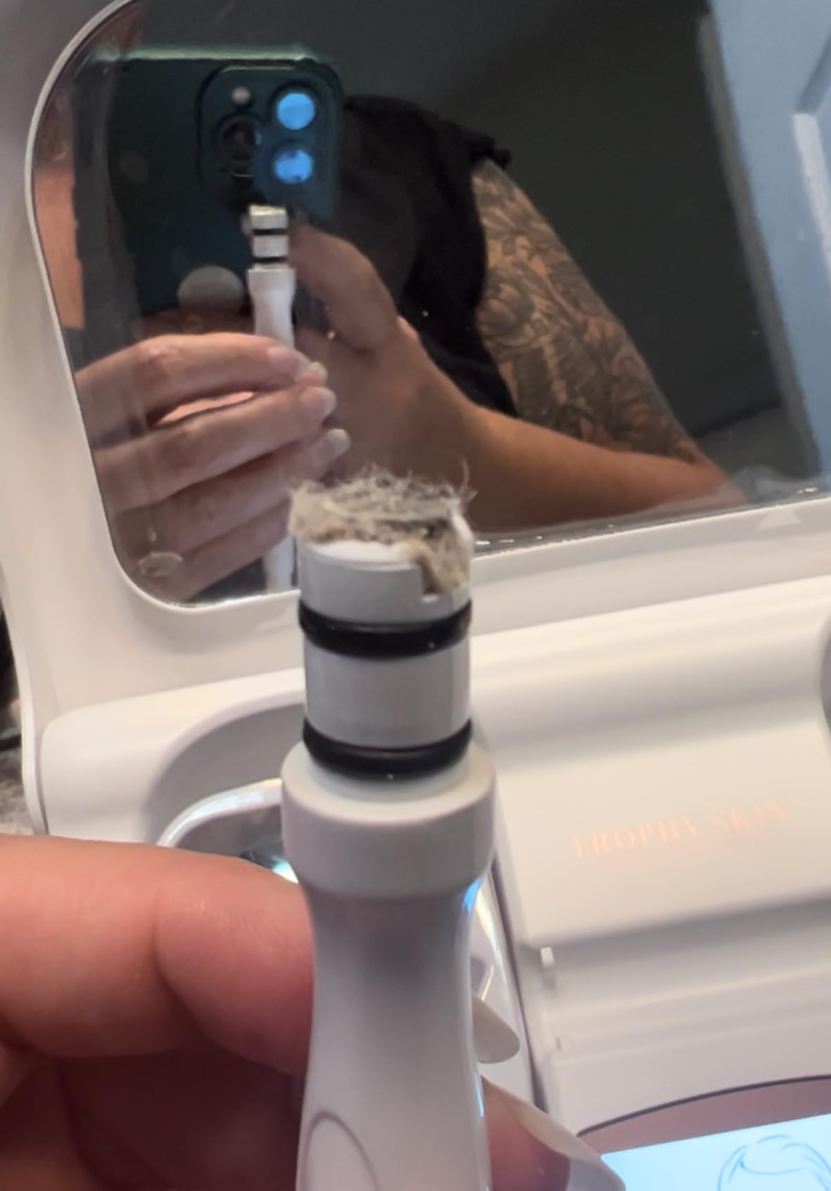 Trophy Skin MicrodermMD - At Home Microdermabrasion Kit - Anti Aging and Acne Treatment - Contains Real Diamond and Pore Extractor Tips to Rejuvenate Skin - White customer photo 1