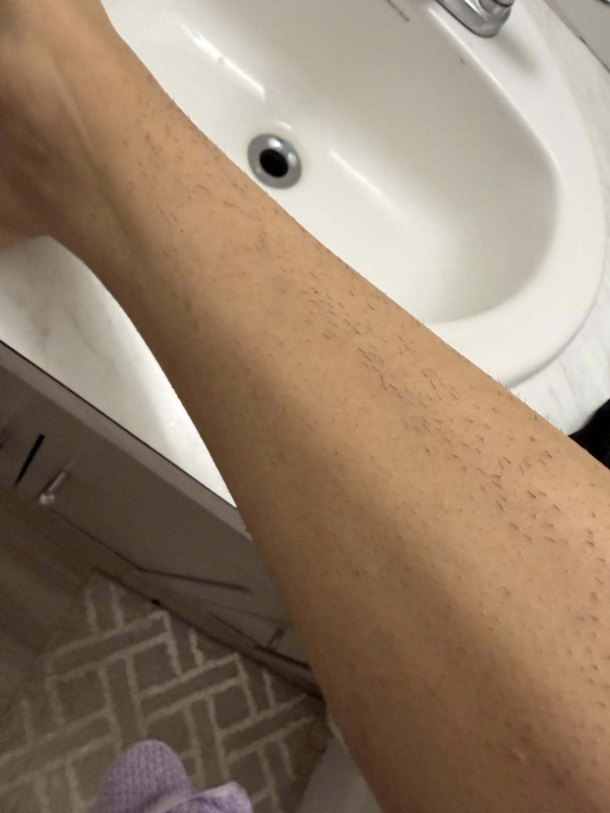 Braun IPL, Silk Expert Pro 5, IPL Hair Removal for Women and Men, Permanent Laser Hair Reduction At-Home, 2 Heads, Pouch, IPL5137 customer photo 1