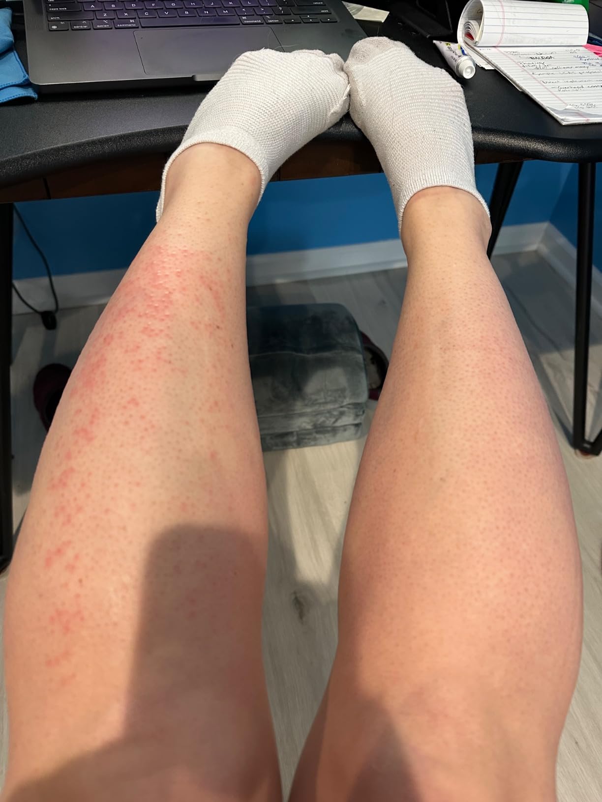 Braun IPL, Silk Expert Pro 5, IPL Hair Removal for Women and Men, Permanent Laser Hair Reduction At-Home, 2 Heads, Pouch, IPL5137 customer photo 2