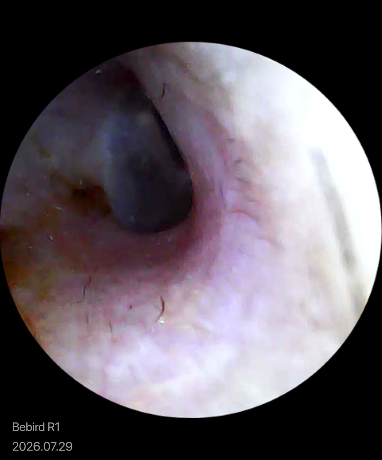 BEBIRD R1 Ear Wax Removal Tool:Ear Cleaner with HD Ear Camera FSA&HSA customer photo 2