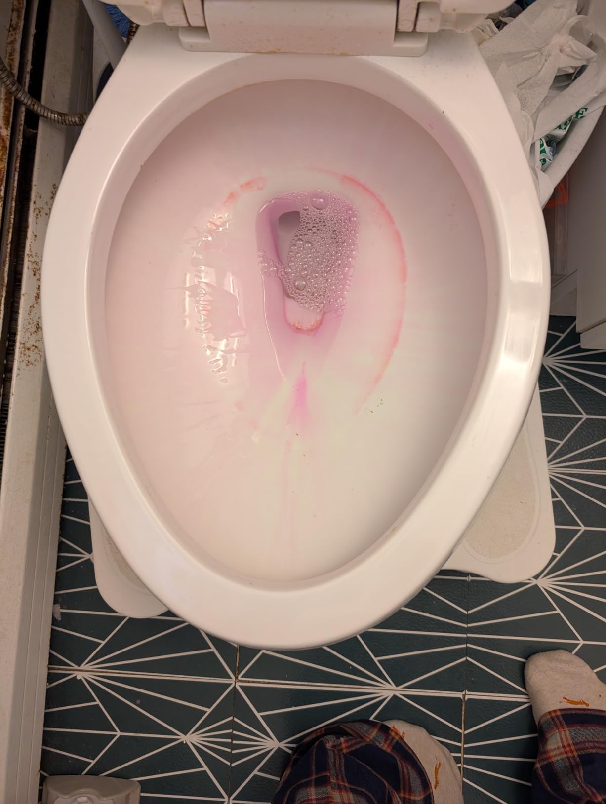 Stardrops The Pink Stuff Miracle Toilet Gel Cleaner, 25 Fl Oz | Clinging Gel Power Removes Stains & Limescale Sparkling Foam Action customer photo 2