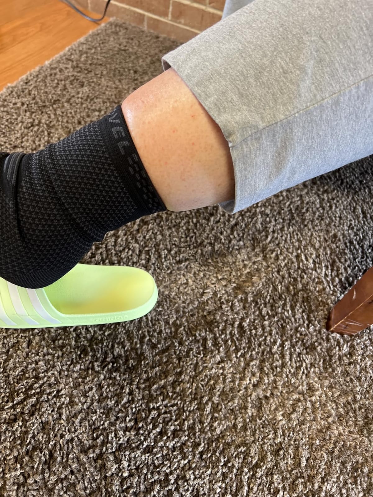 Modvel Foot & Ankle Brace Socks for Sprained Ankle Compression Sleeve - Foot Support for Women & Men - Tendonitis & Arthritis Ankle Brace Sports Running, Torn Ligaments & Women Stabilizing Ankle Wrap customer photo 1