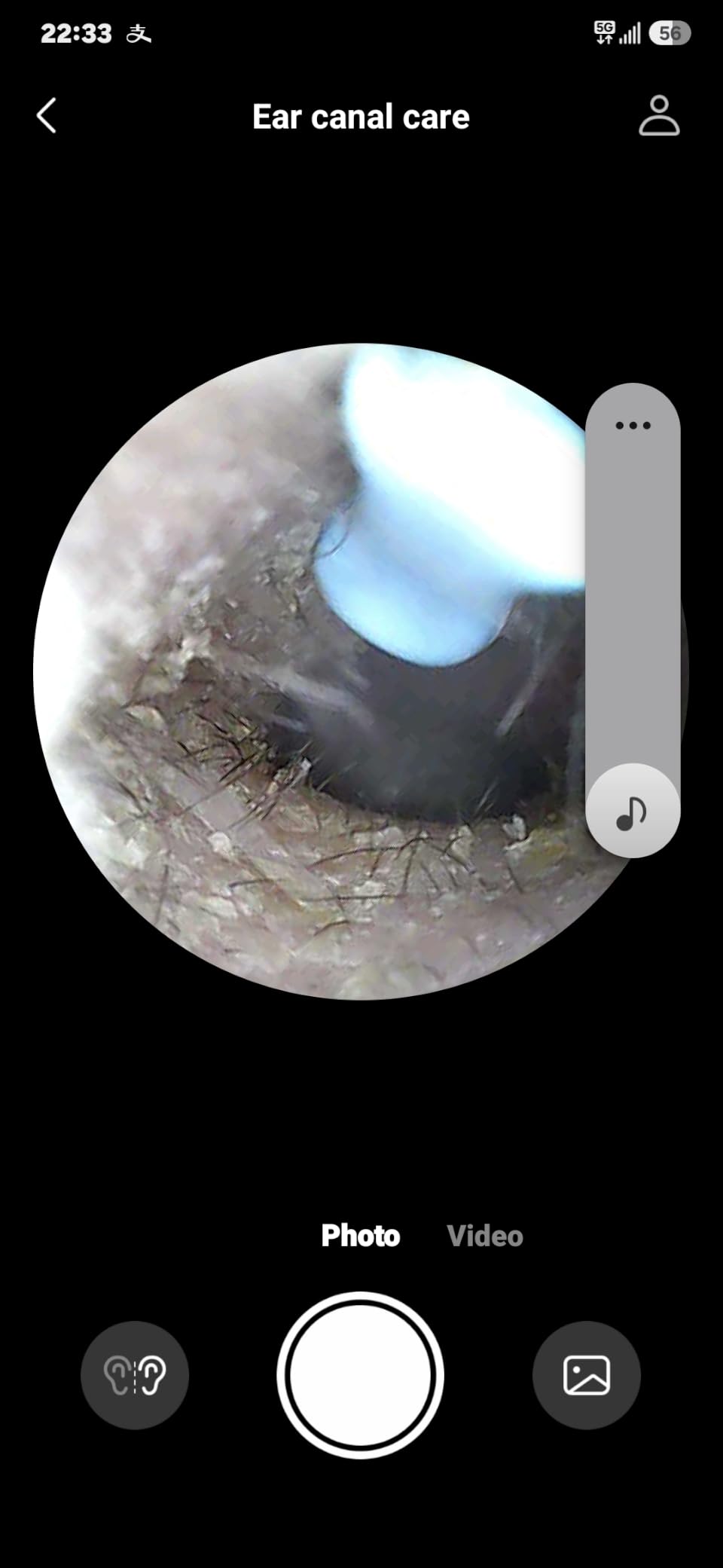 Bebird D39R Ear Wax Removal:Ear Camera with Storage Case &Painless Tweezers customer photo 1