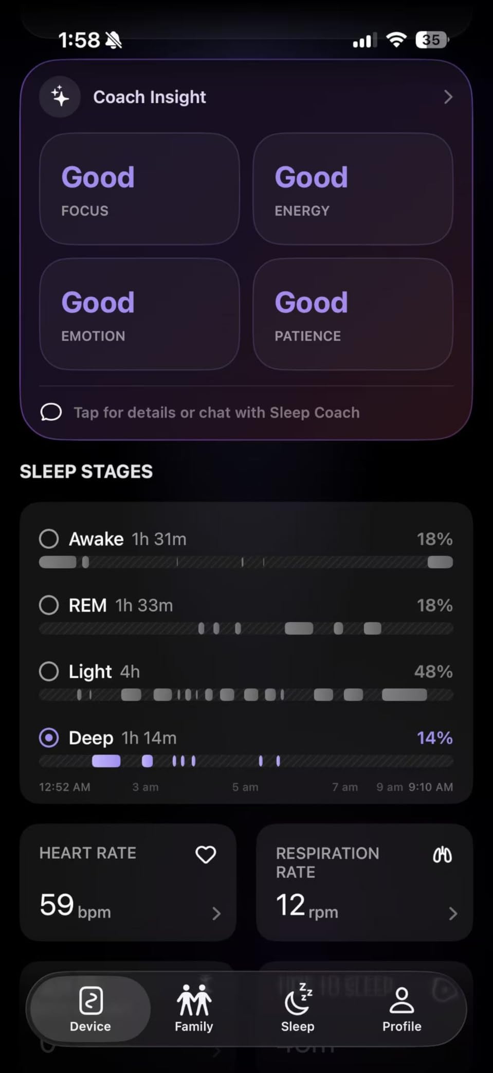 OZI Smart Sleep Tracker, Non-Wearable Contactless Under-Sheet Sleep Monitor | No Monthly Fees, Tracks Sleep Stages, Heart Rate, Breathing, Movement, and Bed-Exit in Real-Time customer photo 2