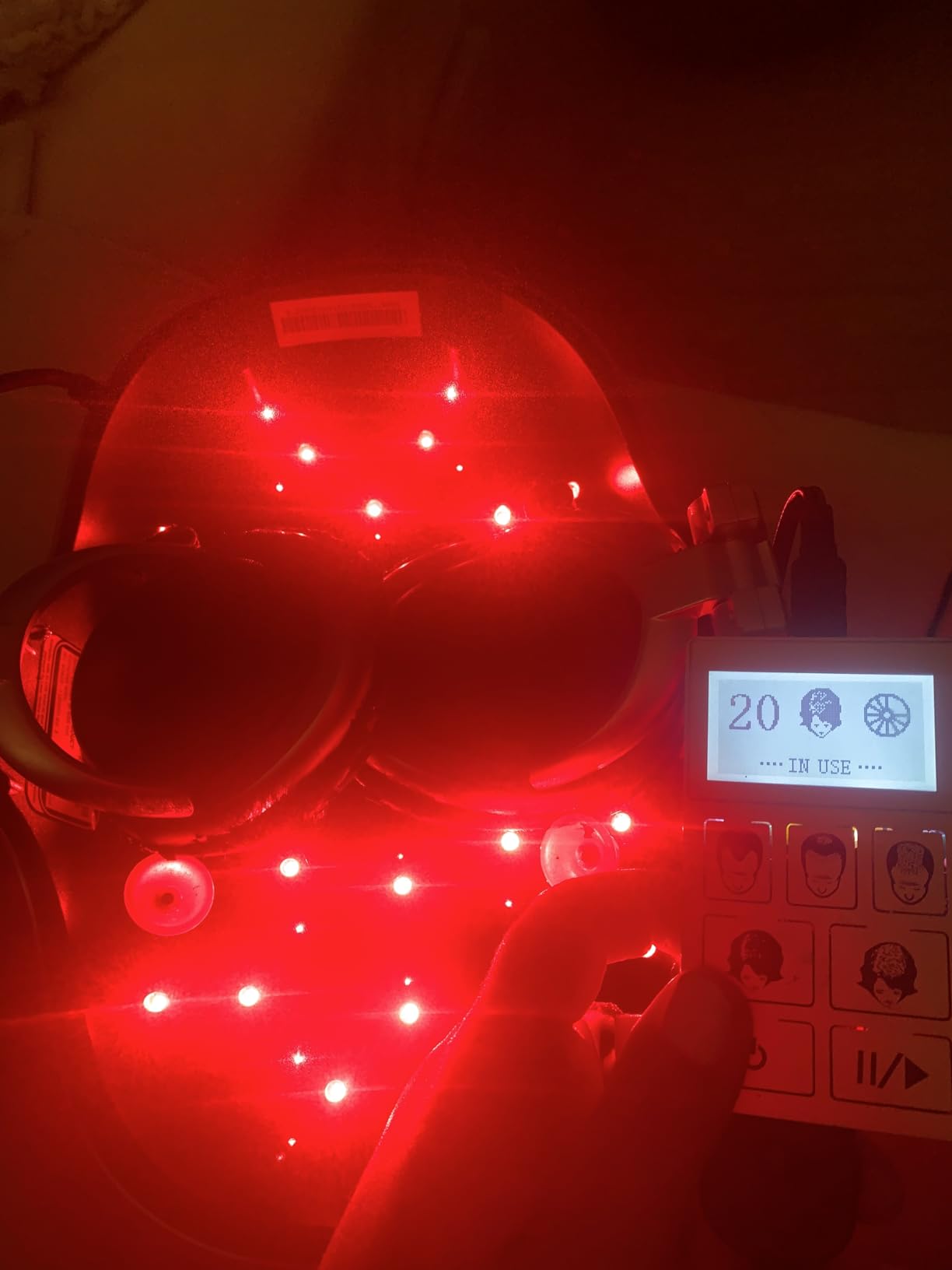 iGrow Laser Hair Growth System - Red Light Helmet Therapy, Clinically Proven, FDA Cleared Laser Cap Hair Growth for Men & Women customer photo 1