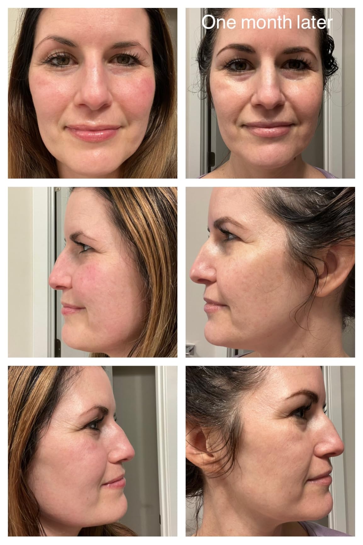 CeraVe Vitamin C Serum customer photo 1