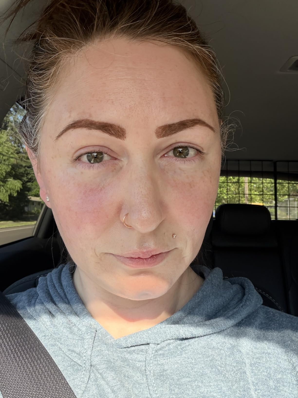 The Ordinary Daily Set customer photo 1