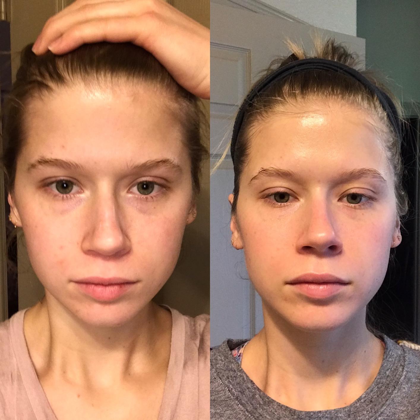 The Ordinary Daily Set customer photo 2