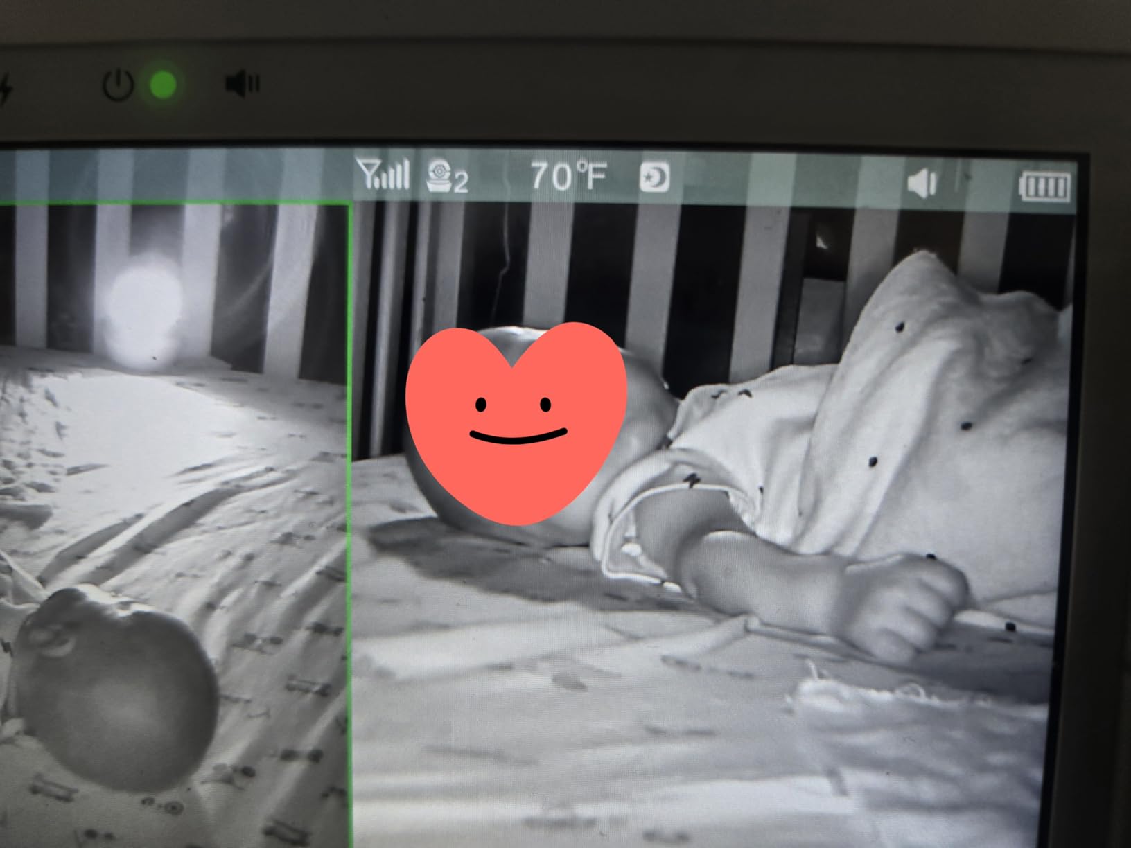 Babysense HD S2 customer photo 1