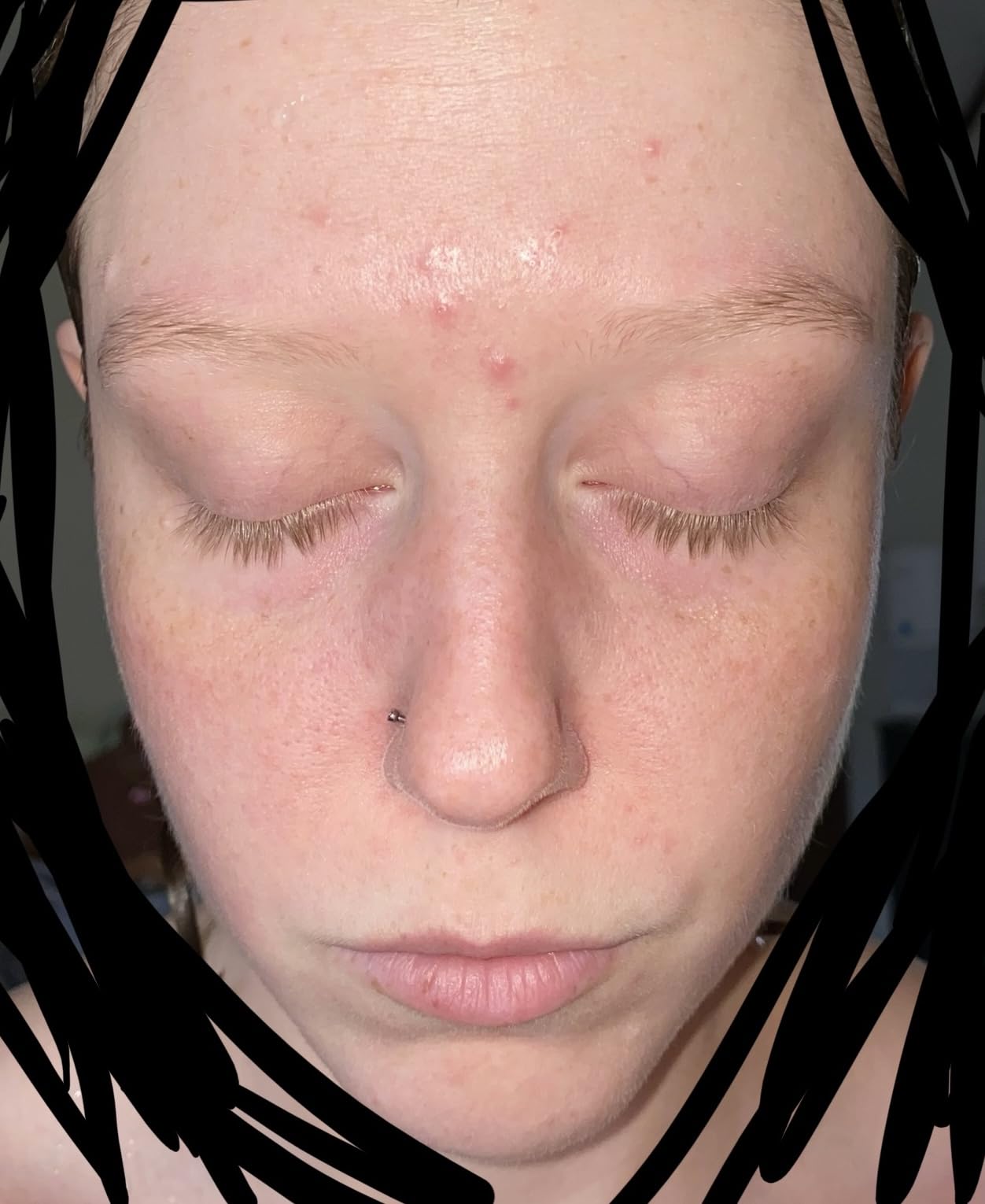 Medicube Zero Pore Cleanser customer photo 1